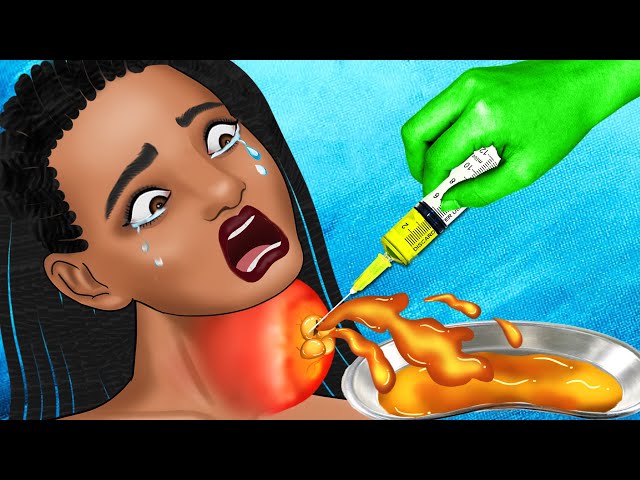 🔴ASMR Get rid of giant acne on the neck - ASMR Animation