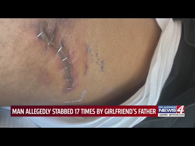 Man allegedly stabbed 17 times by girlfriend's father